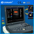DW-C60 Pregnancy 3D laptop Doppler ultrasound system sell